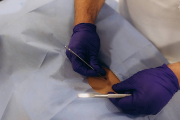 Excision & Removal Procedures