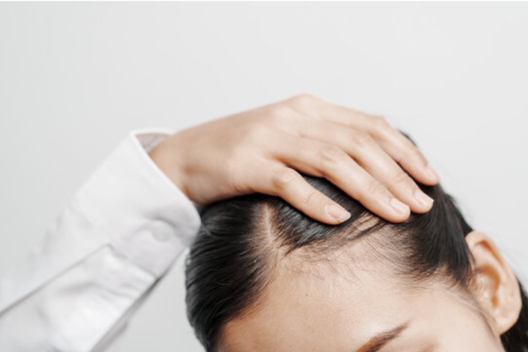 Hair & Scalp Disorders