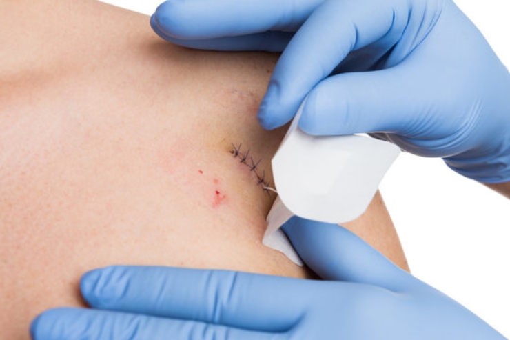 Minor Surgical Dermatology